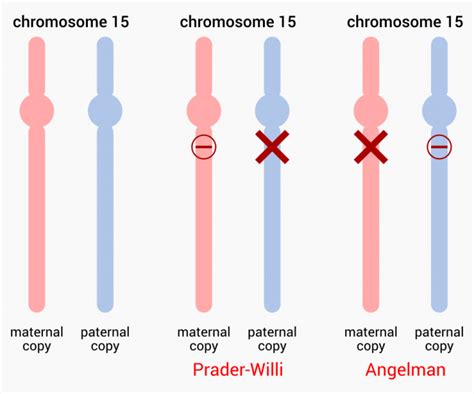 prader willi dna region replication early late|prader willi syndrome genetic testing.